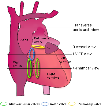 Fetal cardiac scanning - FMF Courses